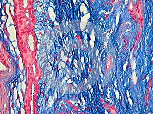 Histology of the Human Breast seen with 3 colors