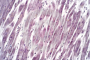 Histology of human cardiac muscle under light microscope view for education