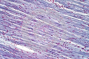 Histology of human cardiac muscle under light microscope view for education