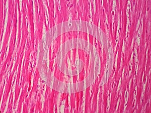 Histology of human cardiac muscle photo