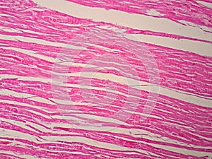 Histology of human cardiac muscle photo