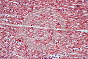 Histology of human cardiac muscle under microscope view for educ