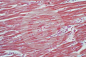 Histology of human cardiac muscle under microscope view for educ