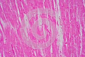 Histology of human cardiac muscle under microscope view for education