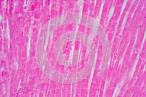 Histology of human cardiac muscle under microscope view for education