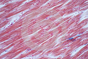 Histology of human cardiac muscle under microscope view for education