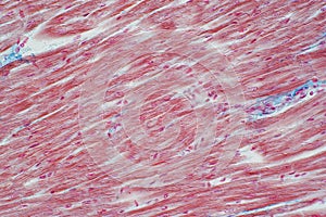 Histology of human cardiac muscle under microscope view for educ