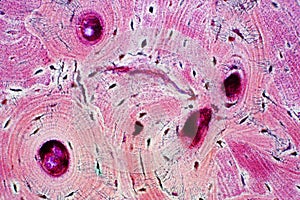 Histology of human compact bone tissue under microscope view for