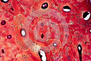 Histology of human compact bone tissue under microscope view for education photo