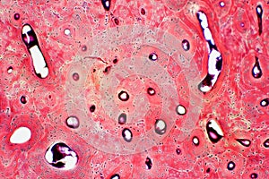 Histology of human compact bone tissue under microscope view for photo