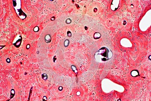 Histology of human compact bone tissue under microscope view for photo
