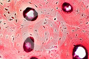 Histology of human compact bone tissue under microscope view for