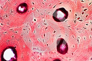 Histology of human compact bone tissue under microscope view for photo