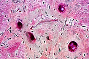 Histology of human compact bone tissue under microscope view for photo