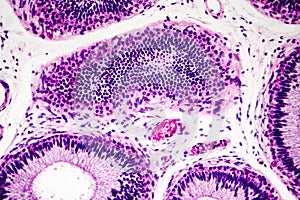 Histology of human epididymis tissue