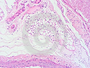 Histology of human heart muscle tissue