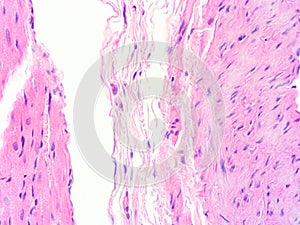 Histology of human heart muscle tissue