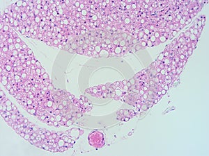 Histology of human heart muscle tissue