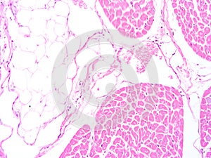 Histology of human heart muscle tissue