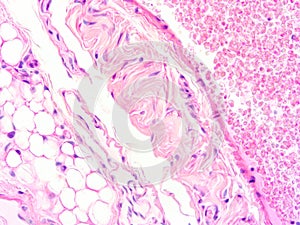 Histology of human heart muscle tissue