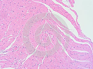 Histology of human heart muscle tissue