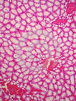 Histology of human kidney photo