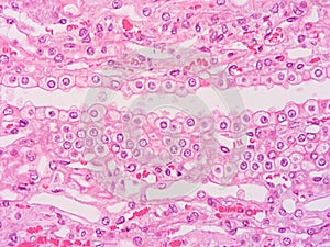 Histology of human tissue photo