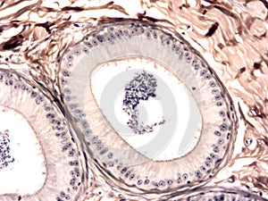 Histology of human tissue photo