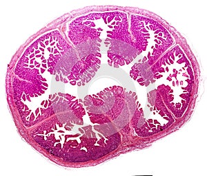 Histology of jejunum, micrograph photo