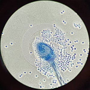 Histology microscopes blood samples