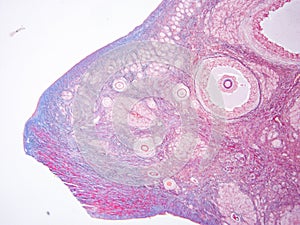 Histology of ovary human tissue photo