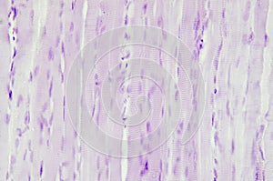 Histology of skeletal muscle