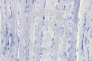 Histology of skeletal muscle photo