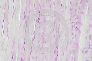 Histology of skeletal muscle photo