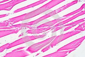 Histology of skeletal muscle under microscope view photo