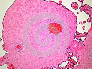 Histology of the umbilical cord photo