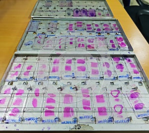 Histopathology slides stained with leishman stain, displayed and ready for microscopy