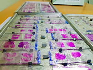 Histopathology slides stained with leishman stain, displayed and ready for microscopy