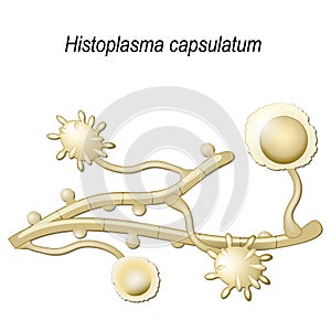 Histoplasma capsulatum photo