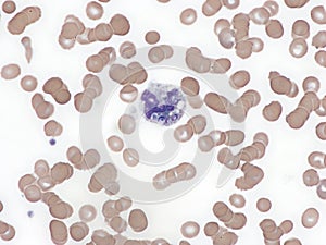 Histoplasma capsulatum in peripheral blood.