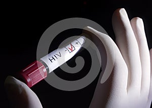 HIV negative photo