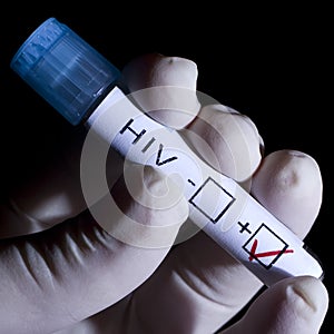 HIV positive