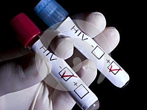 HIV positive and negative photo