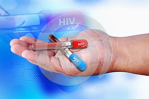 HIV positive and negative