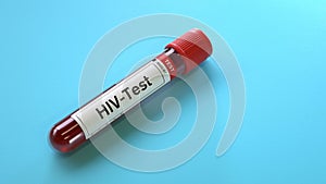 Hiv virus test