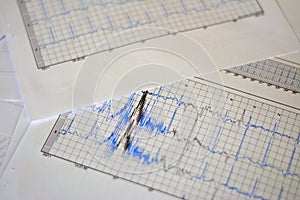 Holter graph or map printed on paper, Brazil, South America, selective focus, top view