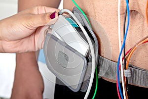 Holter Monitor photo