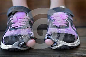 Homeless Child Wearing Old Worn Out Shoes with Holes in them Toes Sticking Out