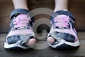 Homeless Child Wearing Old Worn Out Shoes with Holes in them Toes Sticking Out