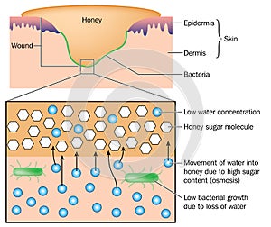 Honey applied to a wound